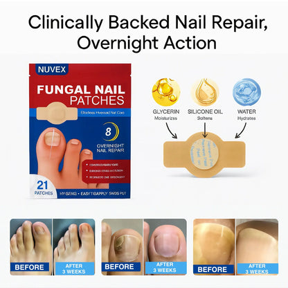 Nuvex Fungal Nail Renewal Patches